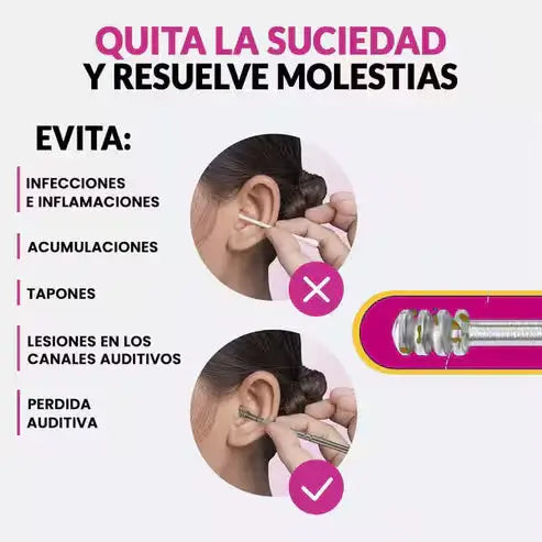Kit AurisKit®: Limpieza Profesional de Oídos sin Dolor Paga 4 y Lleva 6